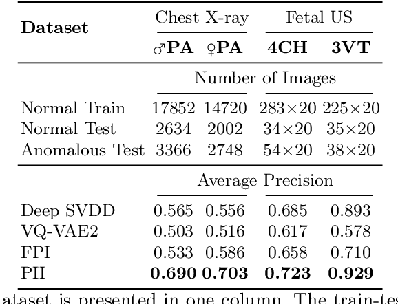 Figure 2 for Detecting Outliers with Poisson Image Interpolation