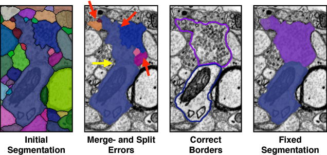 Figure 1 for Guided Proofreading of Automatic Segmentations for Connectomics