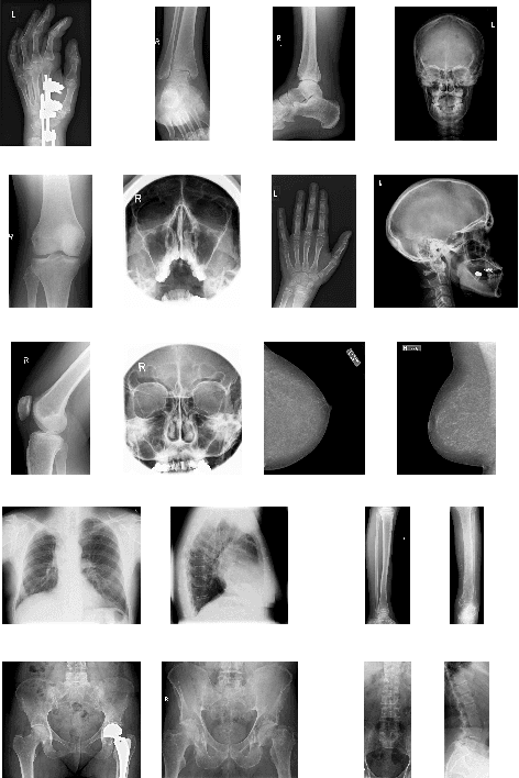 Figure 3 for Effective sparse representation of X-Ray medical images