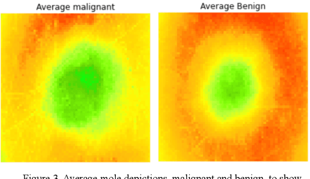 Figure 3 for Melatect: A Machine Learning Model Approach For Identifying Malignant Melanoma in Skin Growths