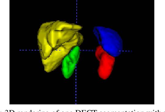 Figure 3 for Towards Automatic Abdominal Multi-Organ Segmentation in Dual Energy CT using Cascaded 3D Fully Convolutional Network