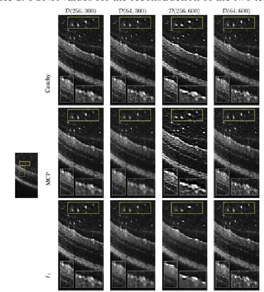 Figure 3 for Non-convex Super-resolution of OCT images via sparse representation