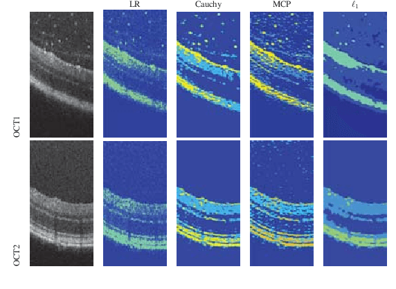 Figure 4 for Non-convex Super-resolution of OCT images via sparse representation