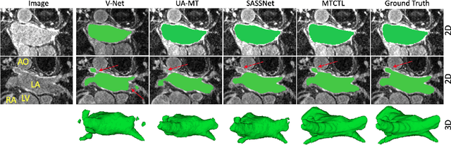 Figure 3 for A Multi-Task Cross-Task Learning Architecture for Ad-hoc Uncertainty Estimation in 3D Cardiac MRI Image Segmentation