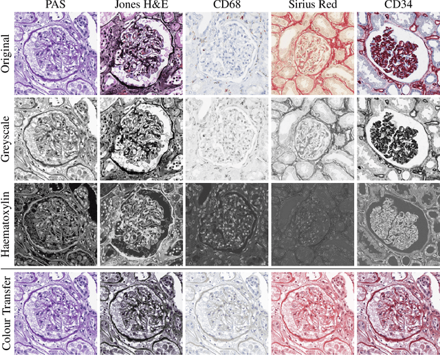 Figure 1 for Strategies for Training Stain Invariant CNNs