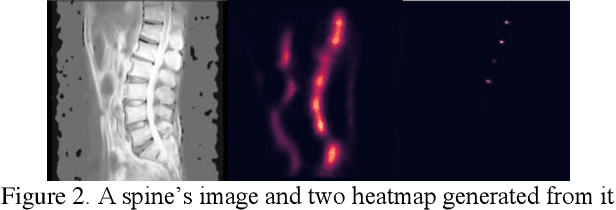 Figure 2 for Spine Landmark Localization with combining of Heatmap Regression and Direct Coordinate Regression