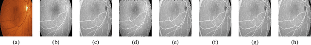 Figure 3 for Elastic Registration of Medical Images With GANs