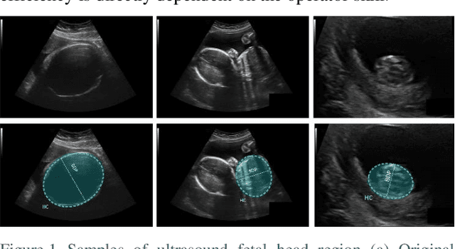 Figure 1 for Localization of Fetal Head in Ultrasound Images by Multiscale View and Deep Neural Networks