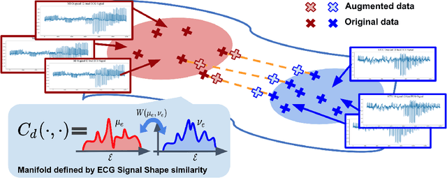 Figure 1 for GeoECG: Data Augmentation via Wasserstein Geodesic Perturbation for Robust Electrocardiogram Prediction