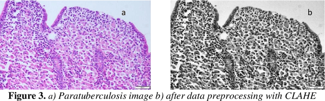 Figure 3 for Importance of Preprocessing in Histopathology Image Classification Using Deep Convolutional Neural Network