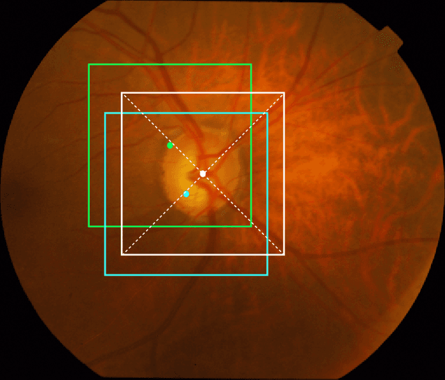 Figure 1 for Optic Disc Segmentation using Disk-Centered Patch Augmentation