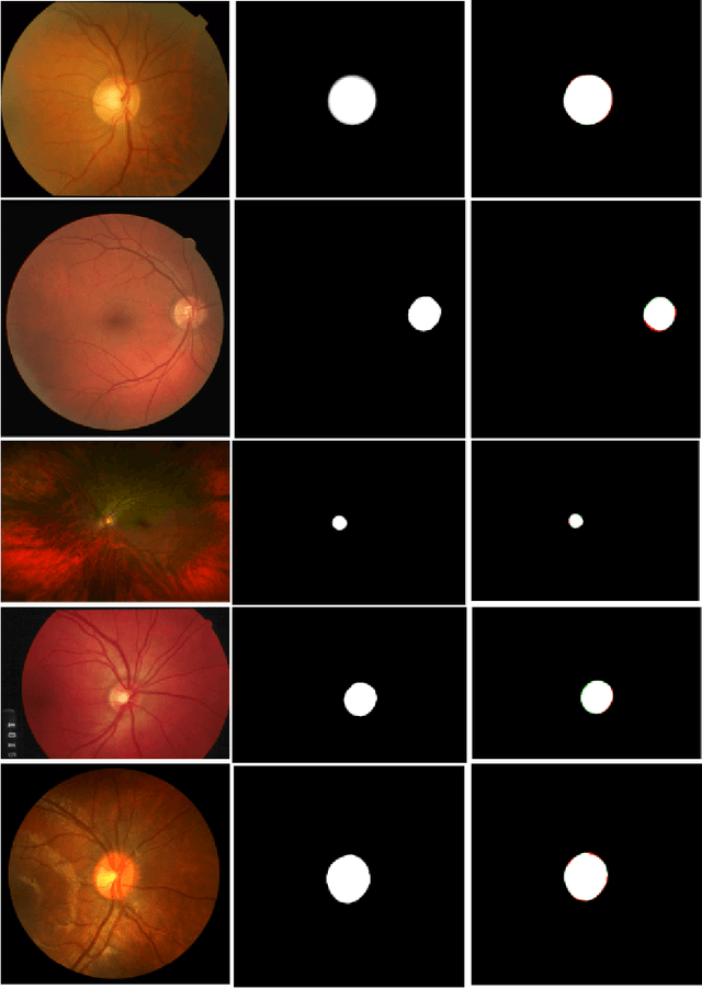 Figure 3 for Optic Disc Segmentation using Disk-Centered Patch Augmentation