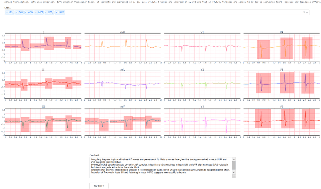 Figure 1 for SIM-ECG: A Signal Importance Mask-driven ECGClassification System