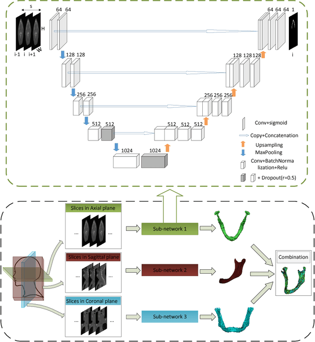 Figure 1 for 3D segmentation of mandible from multisectional CT scans by convolutional neural networks