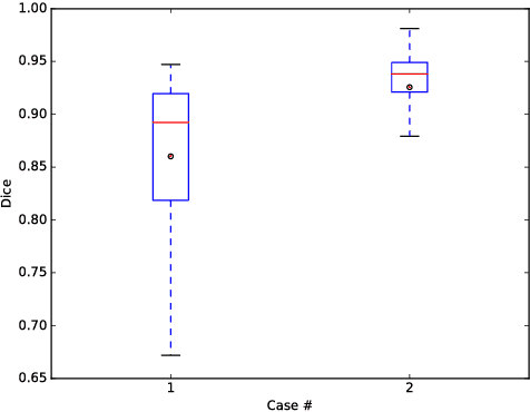 Figure 4 for 3D segmentation of mandible from multisectional CT scans by convolutional neural networks