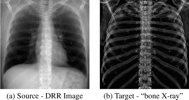 Figure 3 for Bone Structures Extraction and Enhancement in Chest Radiographs via CNN Trained on Synthetic Data