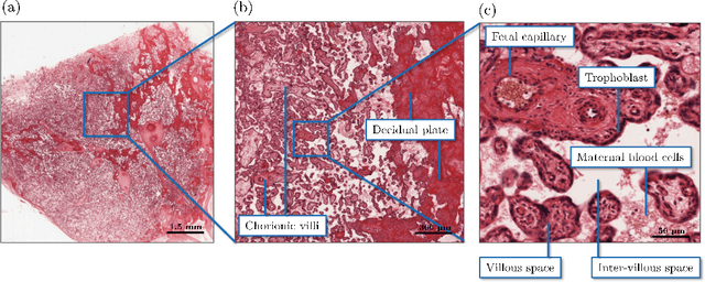 Figure 2 for Automated segmentation and morphological characterization of placental histology images based on a single labeled image