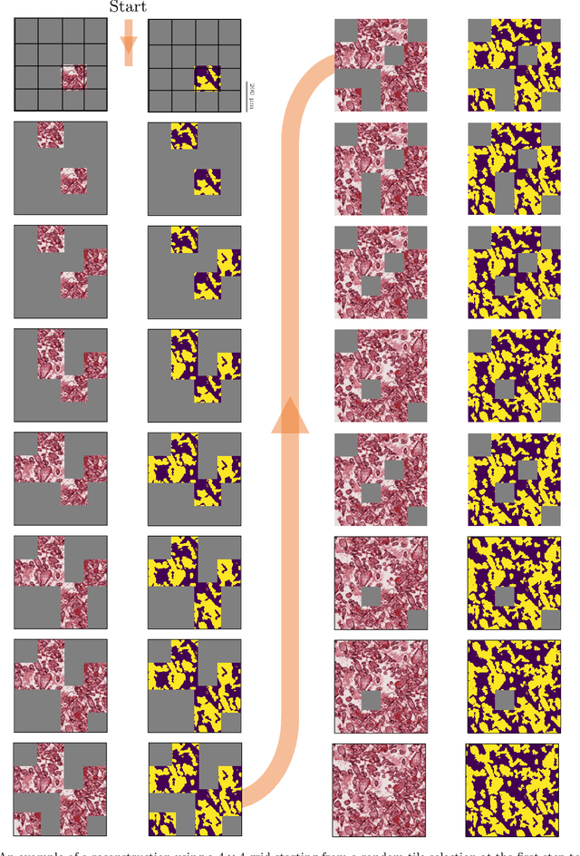 Figure 4 for Automated segmentation and morphological characterization of placental histology images based on a single labeled image