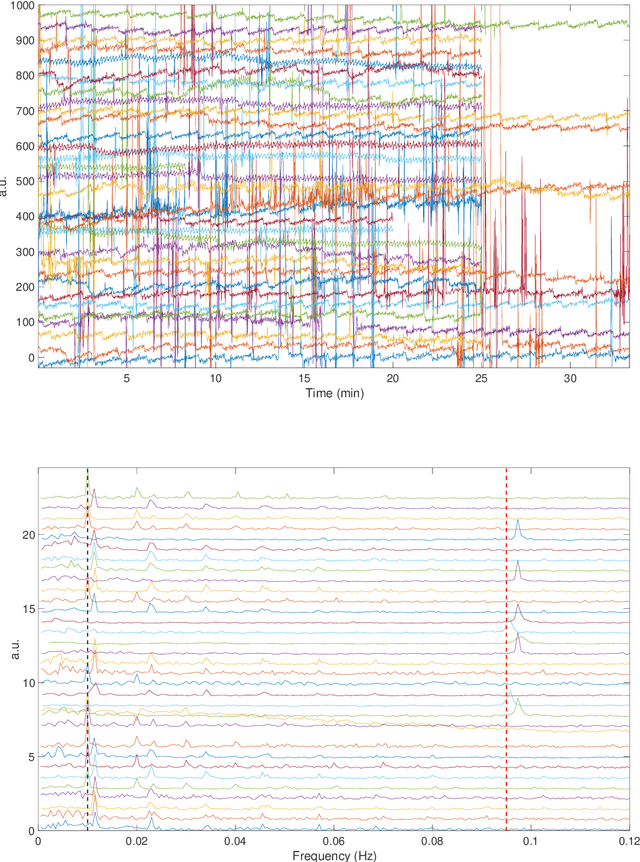 Figure 2 for Calibration for massive physiological signal collection in hospital -- Sawtooth artifact in beat-to-beat pulse transit time measured from patient monitor data