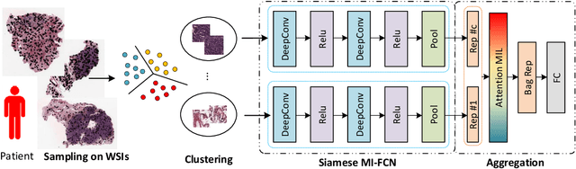 Figure 1 for Whole Slide Images based Cancer Survival Prediction using Attention Guided Deep Multiple Instance Learning Networks
