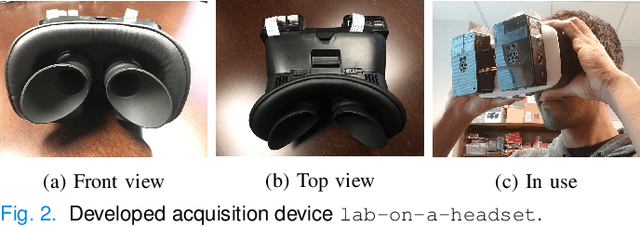 Figure 1 for Relative Afferent Pupillary Defect Screening through Transfer Learning