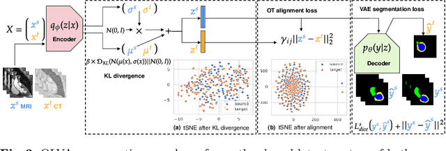 Figure 3 for Optimal Latent Vector Alignment for Unsupervised Domain Adaptation in Medical Image Segmentation