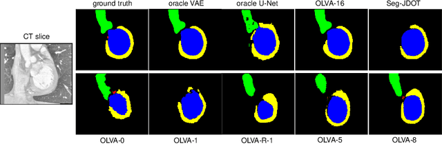 Figure 4 for Optimal Latent Vector Alignment for Unsupervised Domain Adaptation in Medical Image Segmentation