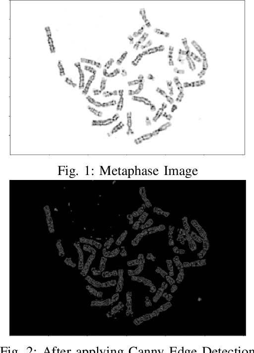 Figure 1 for Chromosome Segmentation Analysis Using Image Processing Techniques and Autoencoders