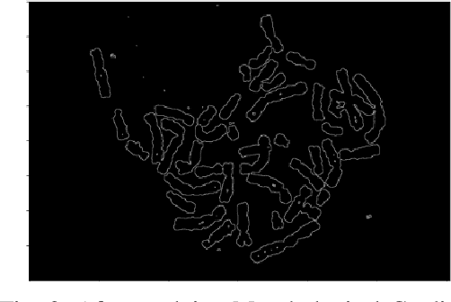 Figure 2 for Chromosome Segmentation Analysis Using Image Processing Techniques and Autoencoders