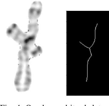 Figure 3 for Chromosome Segmentation Analysis Using Image Processing Techniques and Autoencoders