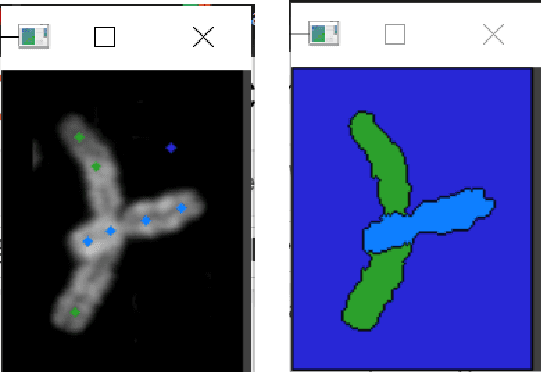 Figure 4 for Chromosome Segmentation Analysis Using Image Processing Techniques and Autoencoders