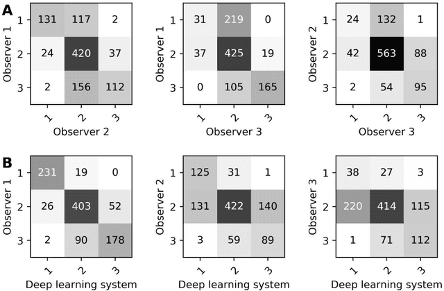 Figure 2 for Deep Learning-Based Grading of Ductal Carcinoma In Situ in Breast Histopathology Images