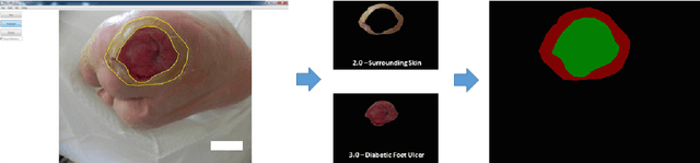 Figure 1 for Fully Convolutional Networks for Diabetic Foot Ulcer Segmentation