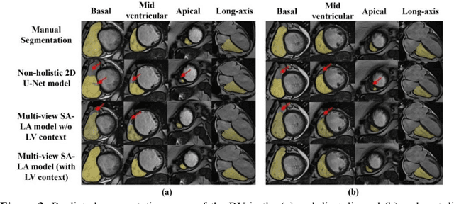 Figure 4 for Multi-view SA-LA Net: A framework for simultaneous segmentation of RV on multi-view cardiac MR Images