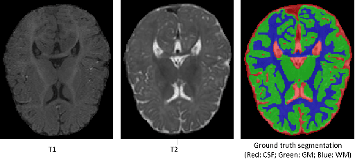 Figure 1 for Multi-stream 3D FCN with Multi-scale Deep Supervision for Multi-modality Isointense Infant Brain MR Image Segmentation