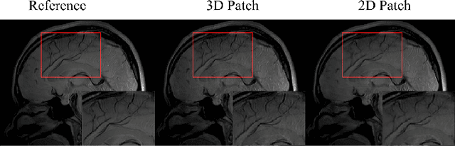 Figure 4 for Accelerating Magnetic Resonance Parametric Mapping Using Simultaneously Spatial Patch-based and Parametric Group-based Low-rank Tensors (SMART)