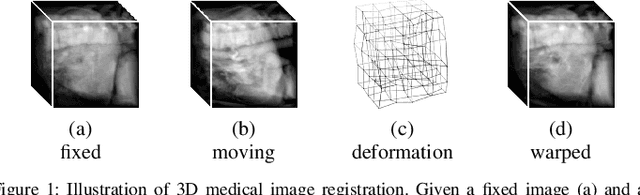 Figure 1 for Unsupervised 3D End-to-End Medical Image Registration with Volume Tweening Network