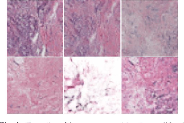 Figure 3 for Dectecting Invasive Ductal Carcinoma with Semi-Supervised Conditional GANs