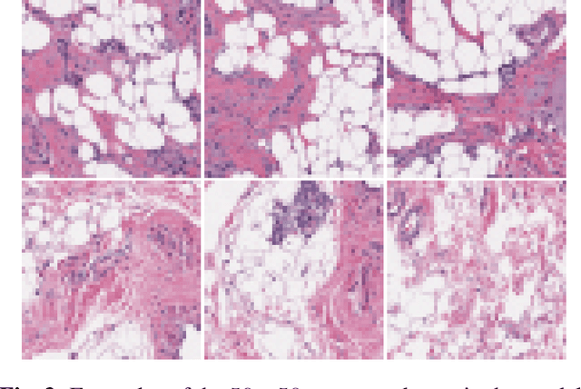 Figure 4 for Dectecting Invasive Ductal Carcinoma with Semi-Supervised Conditional GANs