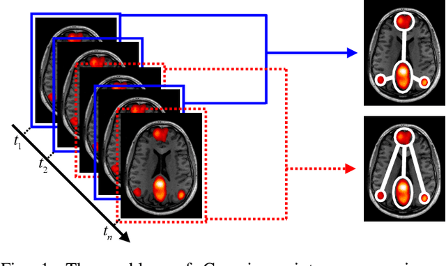 Figure 1 for Gaussian Mixture Graphical Lasso with Application to Edge Detection in Brain Networks