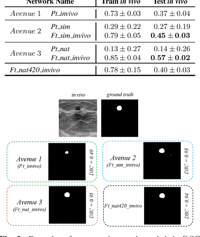 Figure 4 for Breast lesion segmentation in ultrasound images with limited annotated data