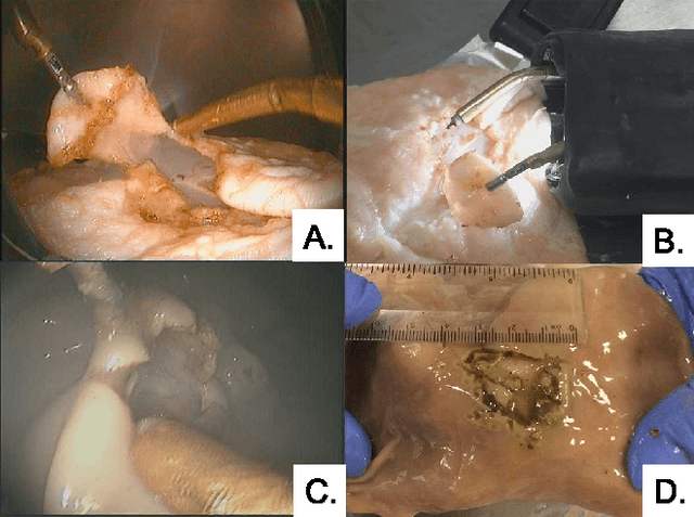 Figure 2 for ESD CYCLOPS: A new robotic surgical system for GI surgery