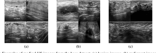 Figure 1 for Semi-supervised classification of medical ultrasound images based on generative adversarial network