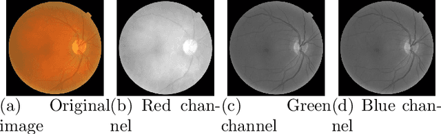 Figure 1 for A Fast and Effective Method of Macula Automatic Detection for Retina Images