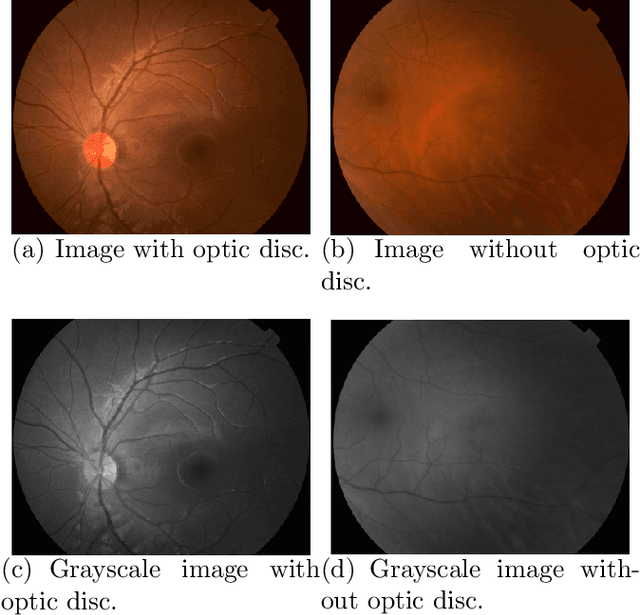 Figure 3 for A Fast and Effective Method of Macula Automatic Detection for Retina Images