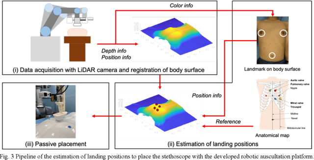 Figure 3 for Toward Fully Automated Robotic Platform for Remote Auscultation