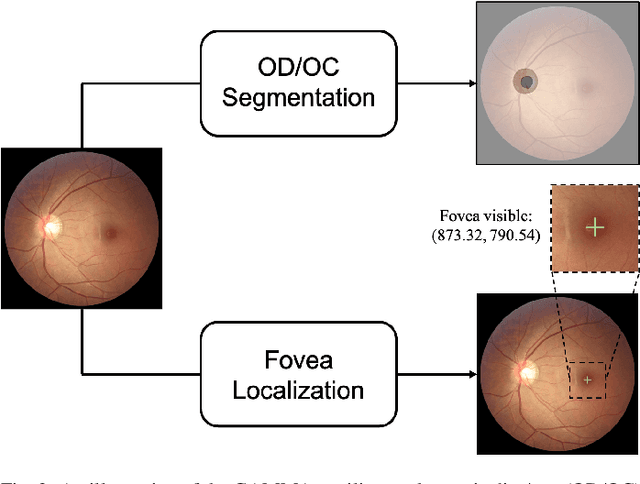 Figure 3 for GAMMA Challenge:Glaucoma grAding from Multi-Modality imAges