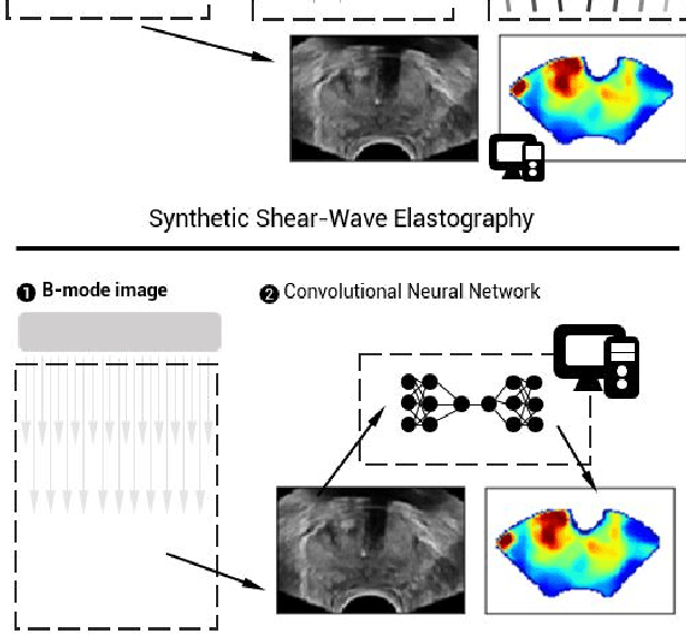 Figure 1 for Synthetic Elastography using B-mode Ultrasound through a Deep Fully-Convolutional Neural Network