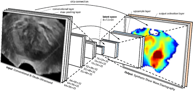 Figure 2 for Synthetic Elastography using B-mode Ultrasound through a Deep Fully-Convolutional Neural Network