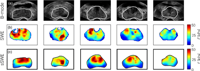 Figure 4 for Synthetic Elastography using B-mode Ultrasound through a Deep Fully-Convolutional Neural Network